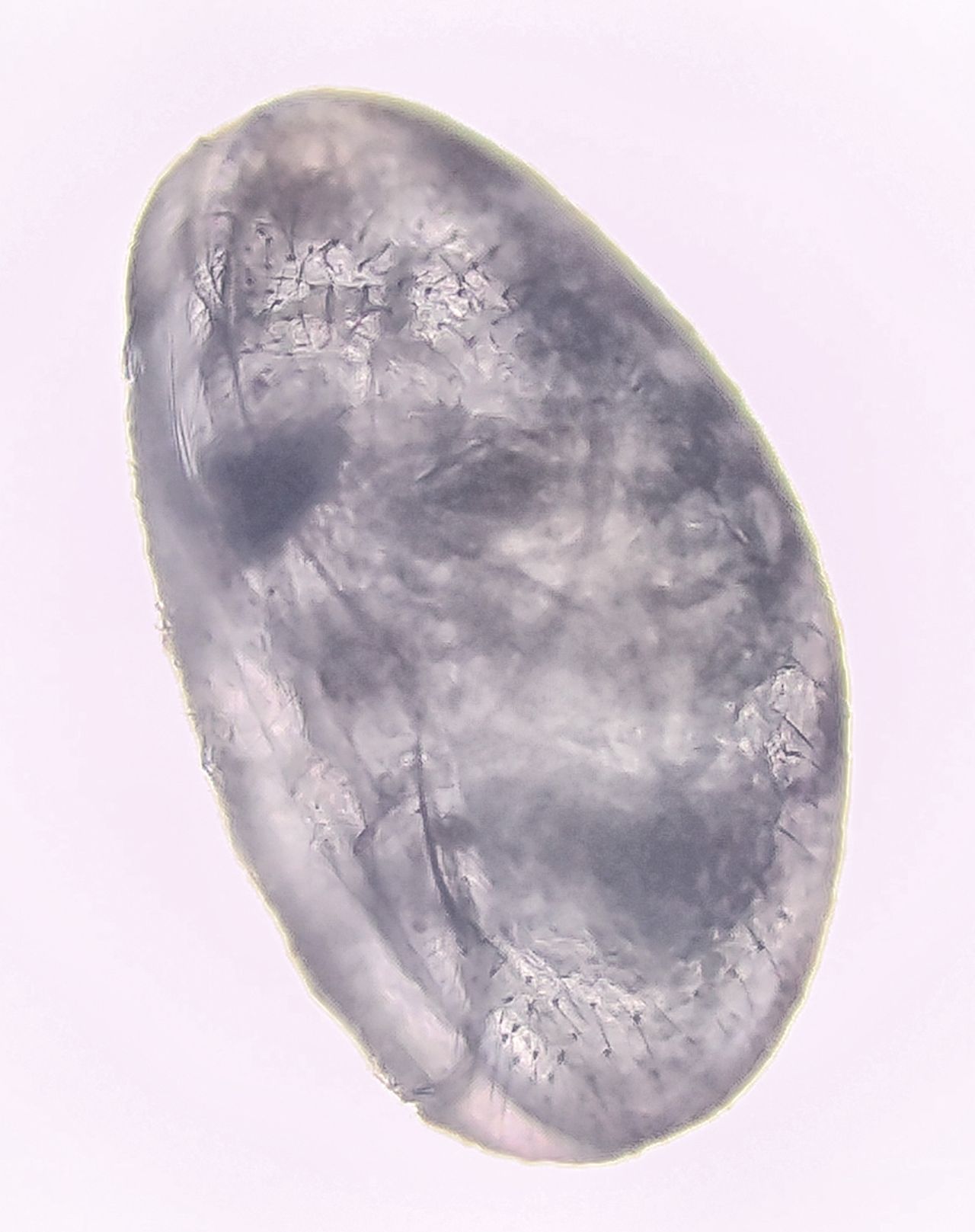 I signori del fango: gli Ostracodi